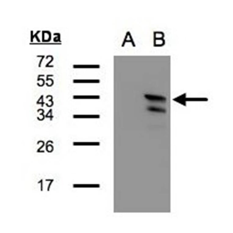 Western blot - CAMK1D antibody from Signalway Antibody (23142) - Antibodies.com