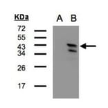 Western blot - CAMK1D antibody from Signalway Antibody (23142) - Antibodies.com