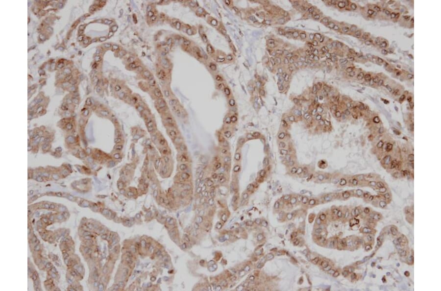 Immunohistochemistry - CAMK1D antibody from Signalway Antibody (23142) - Antibodies.com