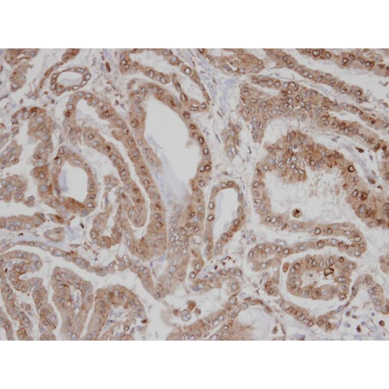 Immunohistochemistry - CAMK1D antibody from Signalway Antibody (23142) - Antibodies.com