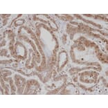 Immunohistochemistry - CAMK1D antibody from Signalway Antibody (23142) - Antibodies.com