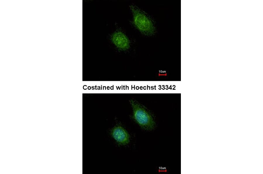 Immunofluorescence - CAMK1D antibody from Signalway Antibody (23142) - Antibodies.com