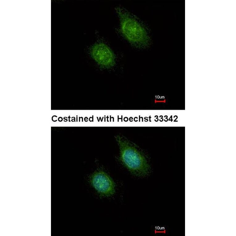 Immunofluorescence - CAMK1D antibody from Signalway Antibody (23142) - Antibodies.com