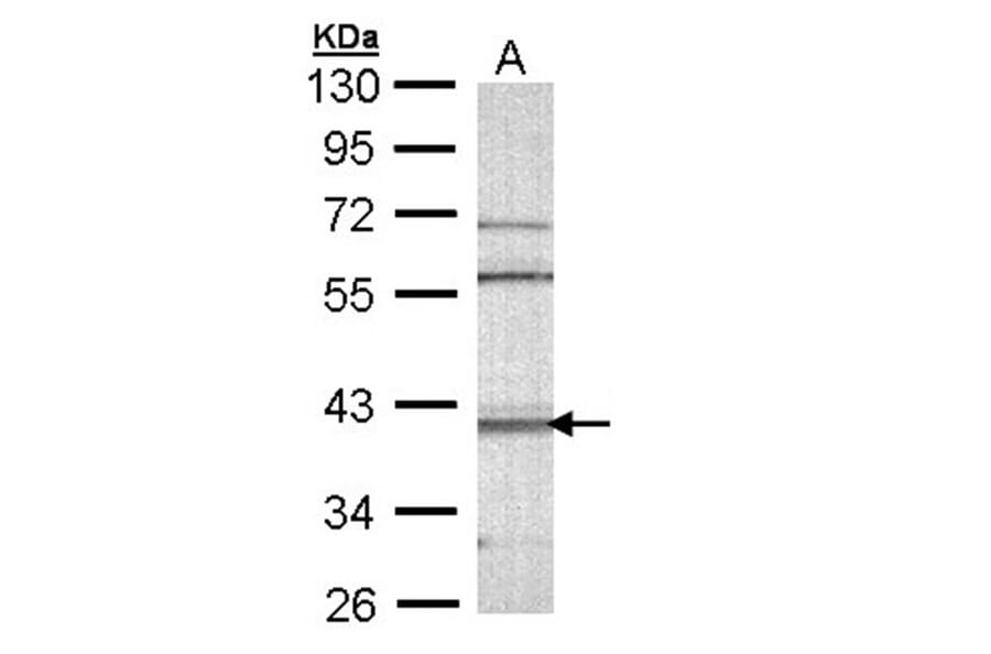 CAMK1D antibody from Signalway Antibody (23144) - Antibodies.com