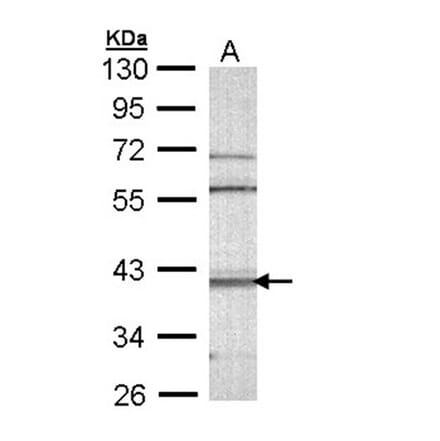 CAMK1D antibody from Signalway Antibody (23144) - Antibodies.com