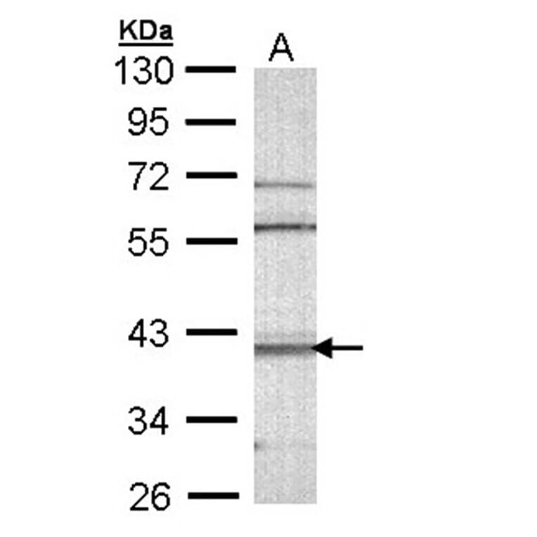 CAMK1D antibody from Signalway Antibody (23144) - Antibodies.com