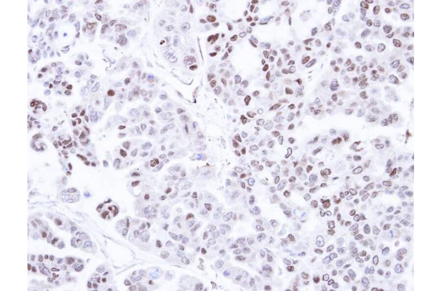 Immunohistochemistry - CAMK1D antibody from Signalway Antibody (23144) - Antibodies.com