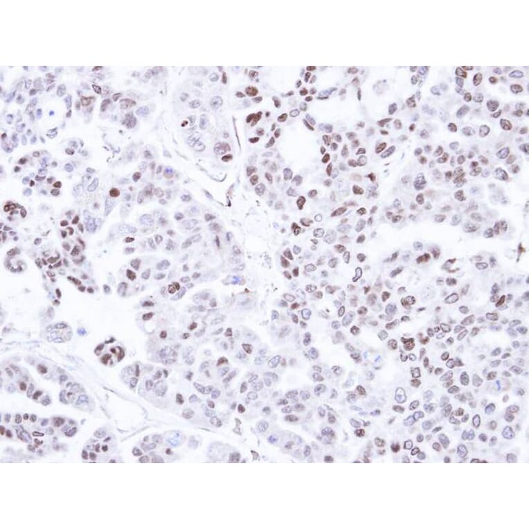 Immunohistochemistry - CAMK1D antibody from Signalway Antibody (23144) - Antibodies.com