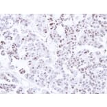 Immunohistochemistry - CAMK1D antibody from Signalway Antibody (23144) - Antibodies.com