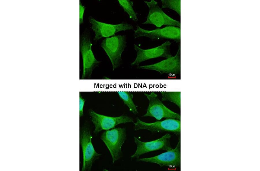 Immunofluorescence - CAMK1D antibody from Signalway Antibody (23144) - Antibodies.com