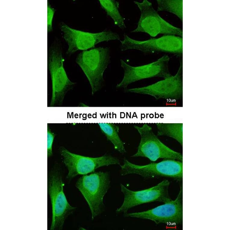 Immunofluorescence - CAMK1D antibody from Signalway Antibody (23144) - Antibodies.com
