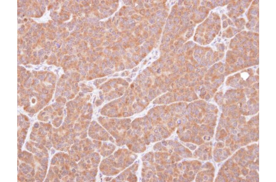 Immunohistochemistry - VCPIP1 antibody from Signalway Antibody (23153) - Antibodies.com