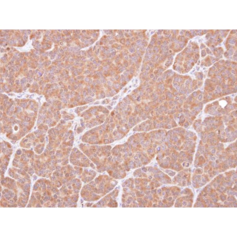 Immunohistochemistry - VCPIP1 antibody from Signalway Antibody (23153) - Antibodies.com