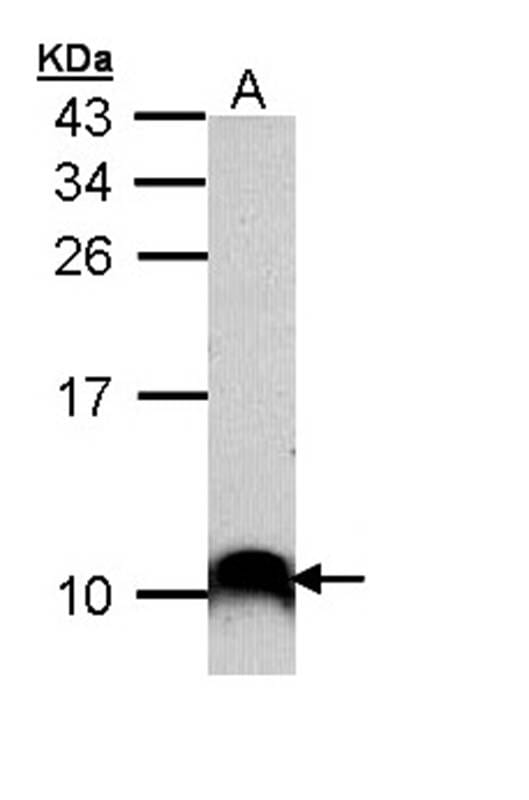 Sample (30 µg of whole cell lysate)  A431 15% SDS PAGE Primary antibody diluted at 1: 1000