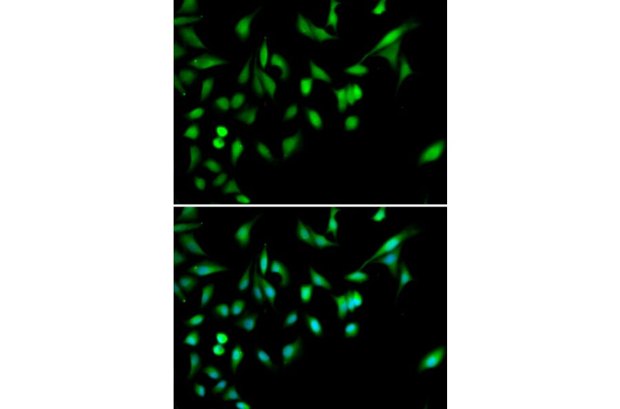 Immunofluorescence - MAPK14 Antibody from Signalway Antibody (32026) - Antibodies.com