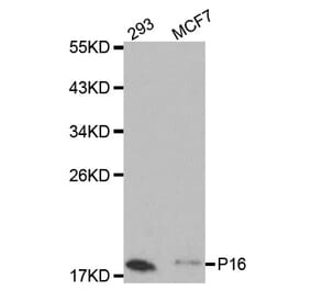Western blot - CDKN2A Antibody from Signalway Antibody (32050) - Antibodies.com