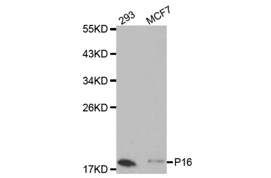 Western blot - CDKN2A Antibody from Signalway Antibody (32050) - Antibodies.com