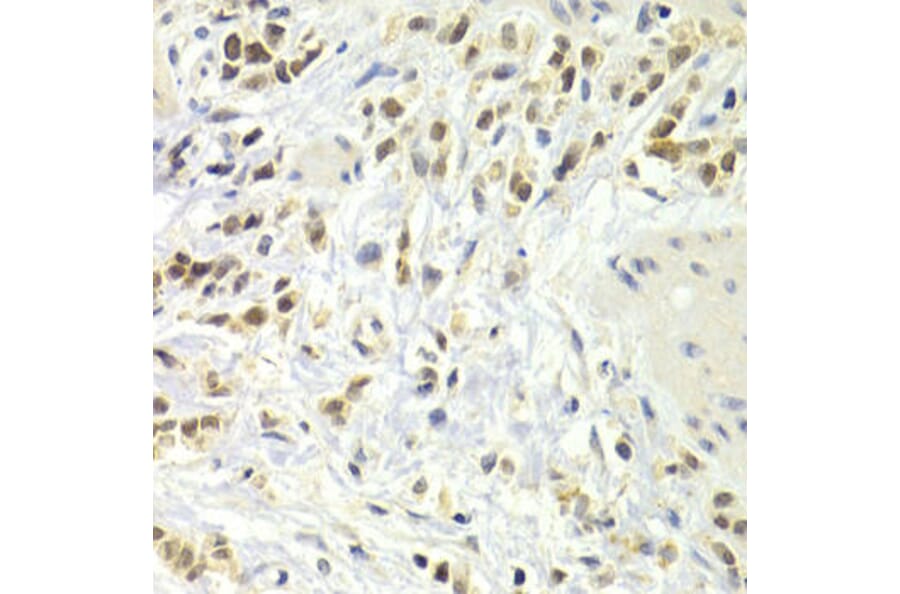Immunohistochemistry - CDKN2A Antibody from Signalway Antibody (32050) - Antibodies.com