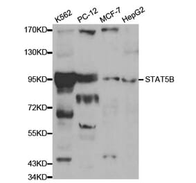 Western blot - STAT5B Antibody from Signalway Antibody (32059) - Antibodies.com