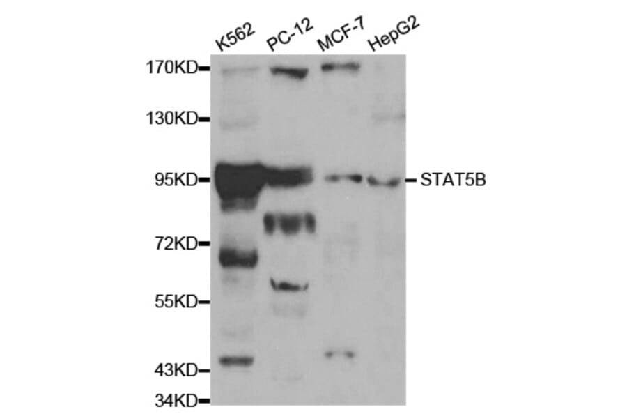 Western blot - STAT5B Antibody from Signalway Antibody (32059) - Antibodies.com