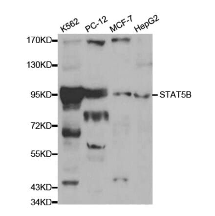 Western blot - STAT5B Antibody from Signalway Antibody (32059) - Antibodies.com