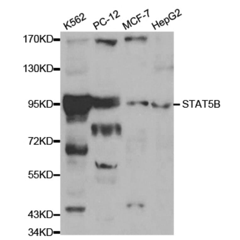 Western blot - STAT5B Antibody from Signalway Antibody (32059) - Antibodies.com