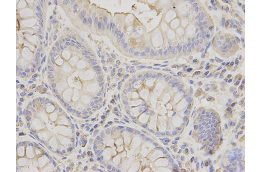 Immunohistochemistry - EEF1A1 Antibody from Signalway Antibody (32103) - Antibodies.com
