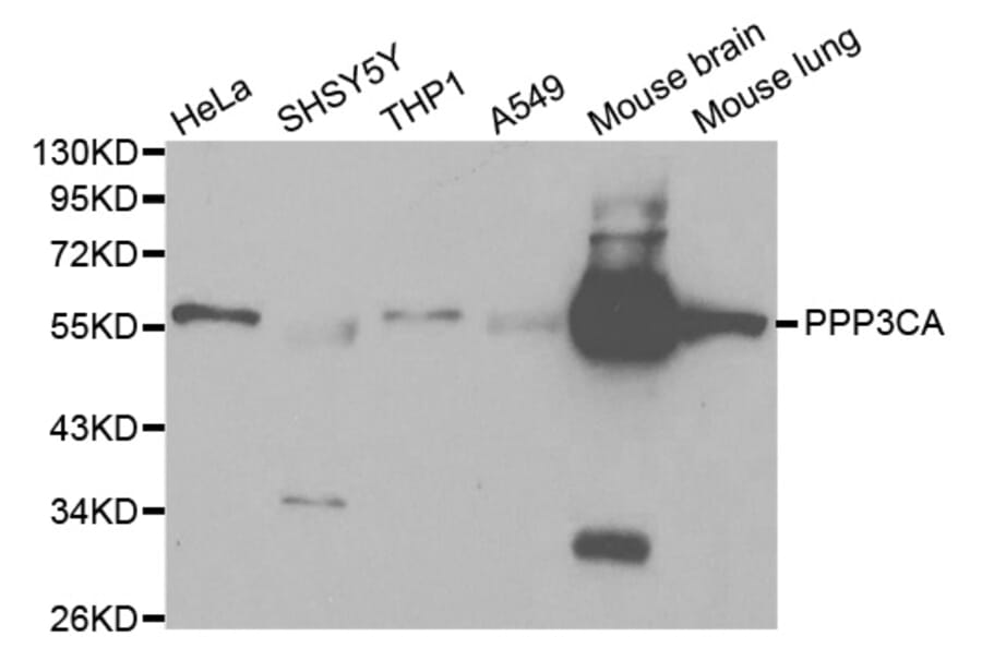 Western blot - PPP3CA Antibody from Signalway Antibody (32139) - Antibodies.com