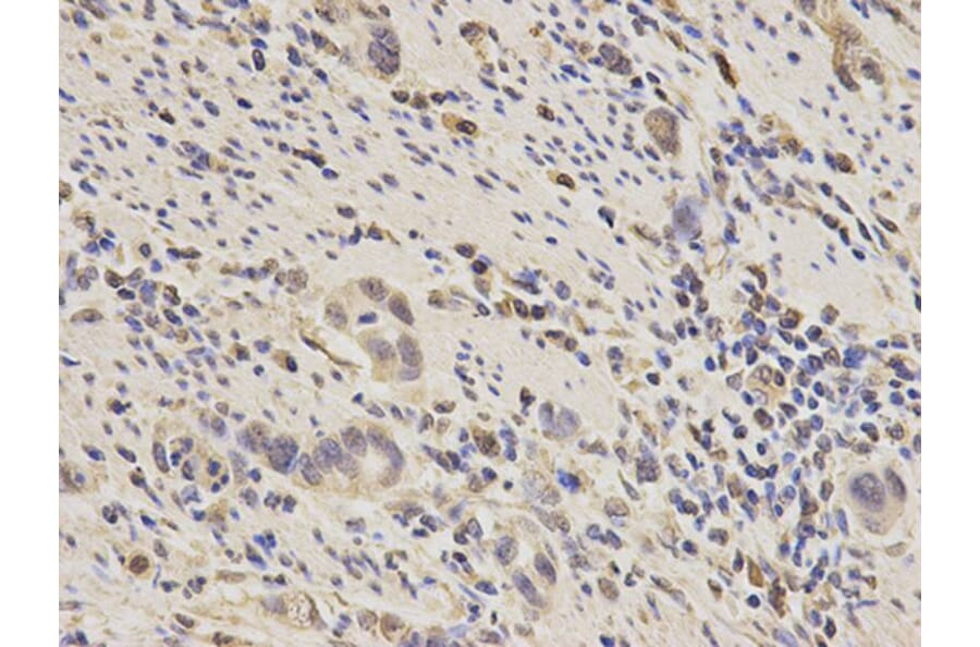 Immunohistochemistry - PPP3CA Antibody from Signalway Antibody (32139) - Antibodies.com