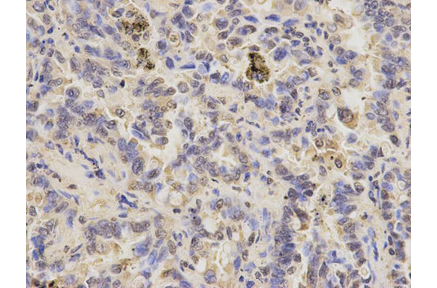 Immunohistochemistry - PPP3CA Antibody from Signalway Antibody (32139) - Antibodies.com