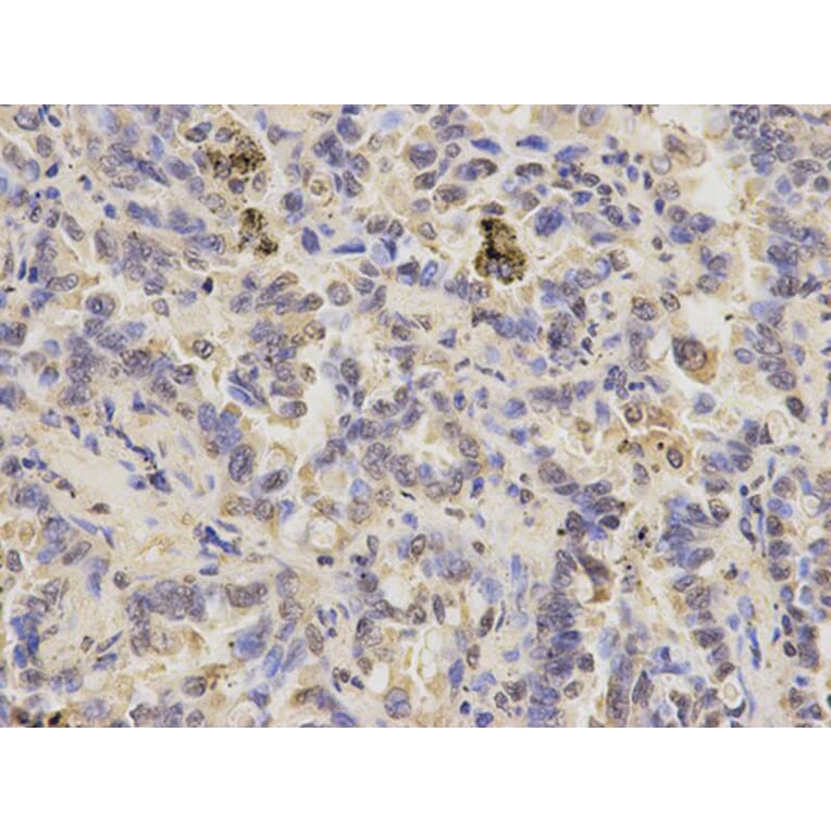 Immunohistochemistry - PPP3CA Antibody from Signalway Antibody (32139) - Antibodies.com