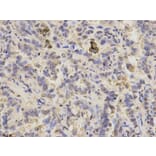 Immunohistochemistry - PPP3CA Antibody from Signalway Antibody (32139) - Antibodies.com
