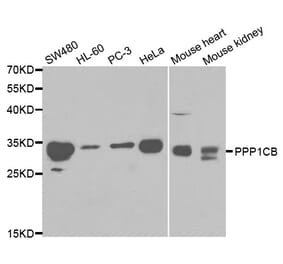 Western blot - PPP1CB Antibody from Signalway Antibody (32152) - Antibodies.com