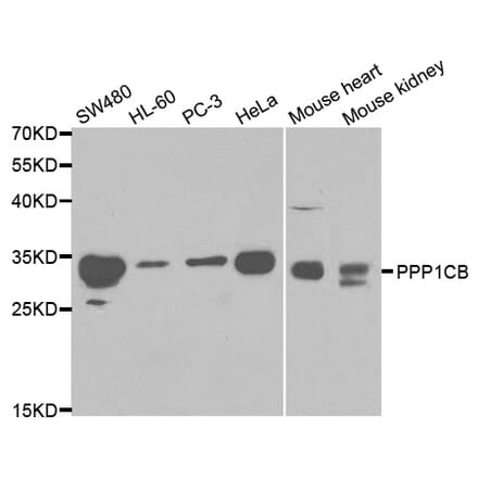 Western blot - PPP1CB Antibody from Signalway Antibody (32152) - Antibodies.com
