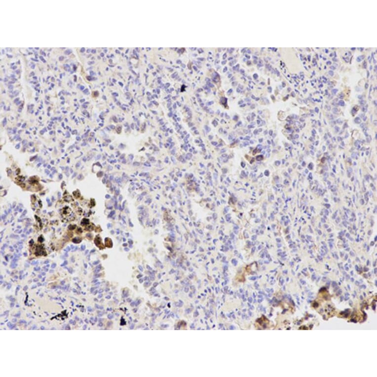Immunohistochemistry - PPP1CB Antibody from Signalway Antibody (32152) - Antibodies.com