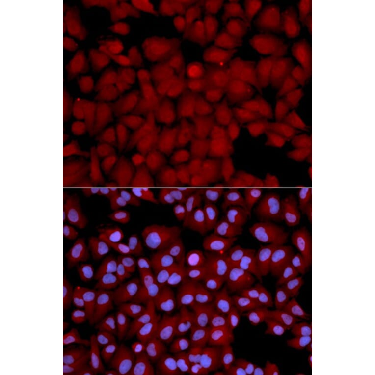 Immunofluorescence - PPP1CB Antibody from Signalway Antibody (32152) - Antibodies.com