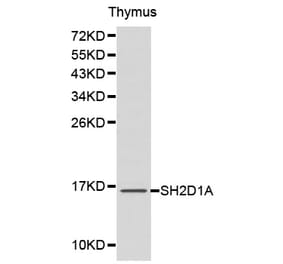 Western blot - SH2D1A Antibody from Signalway Antibody (32179) - Antibodies.com