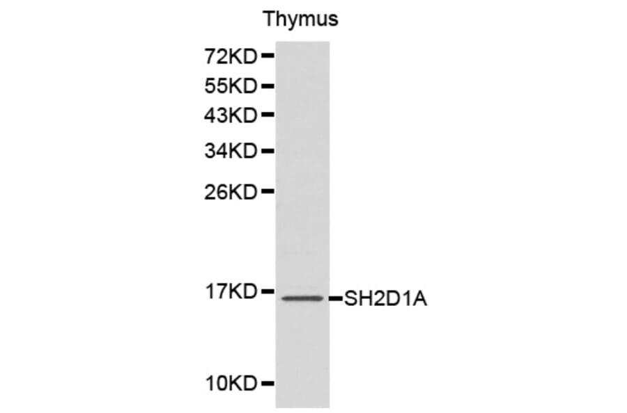 Western blot - SH2D1A Antibody from Signalway Antibody (32179) - Antibodies.com