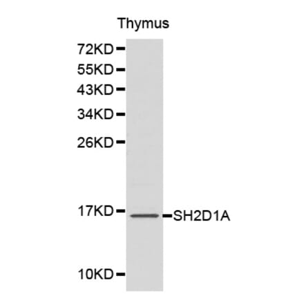 Western blot - SH2D1A Antibody from Signalway Antibody (32179) - Antibodies.com