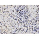 Immunohistochemistry - SH2D1A Antibody from Signalway Antibody (32179) - Antibodies.com
