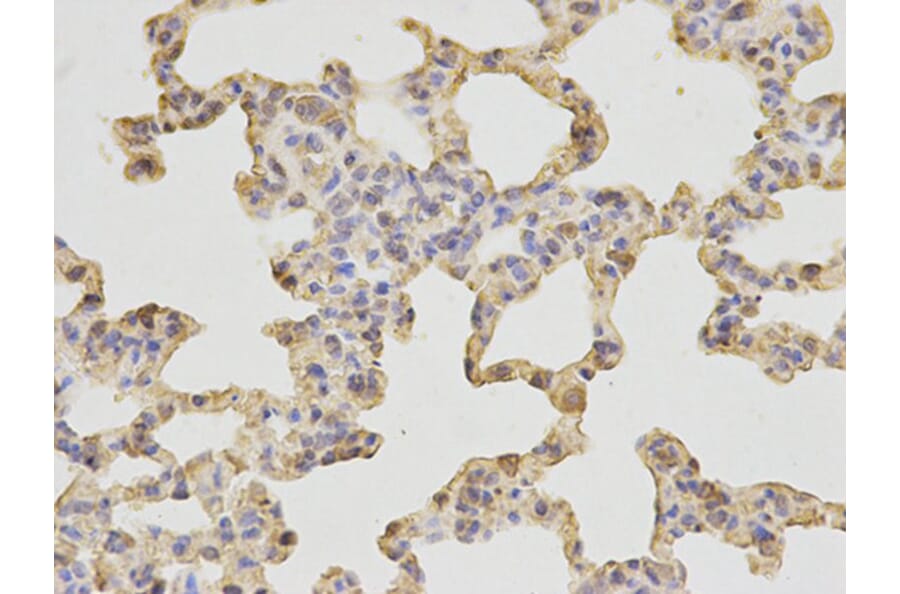 Immunohistochemistry - SH2D1A Antibody from Signalway Antibody (32179) - Antibodies.com