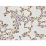 Immunohistochemistry - SH2D1A Antibody from Signalway Antibody (32179) - Antibodies.com