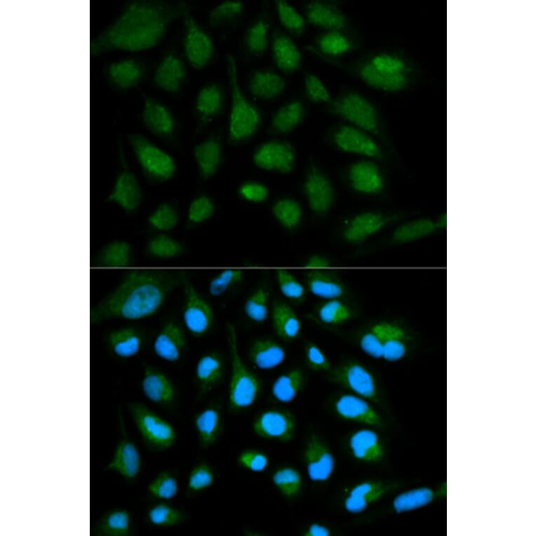 Immunofluorescence - SH2D1A Antibody from Signalway Antibody (32179) - Antibodies.com
