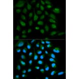 Immunofluorescence - SH2D1A Antibody from Signalway Antibody (32179) - Antibodies.com