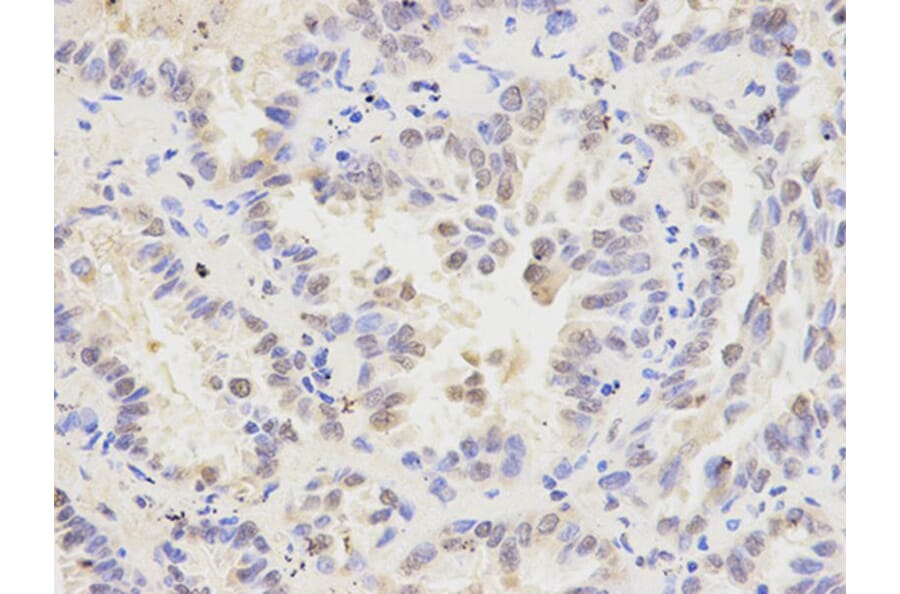Immunohistochemistry - MAD1L1 Antibody from Signalway Antibody (32187) - Antibodies.com