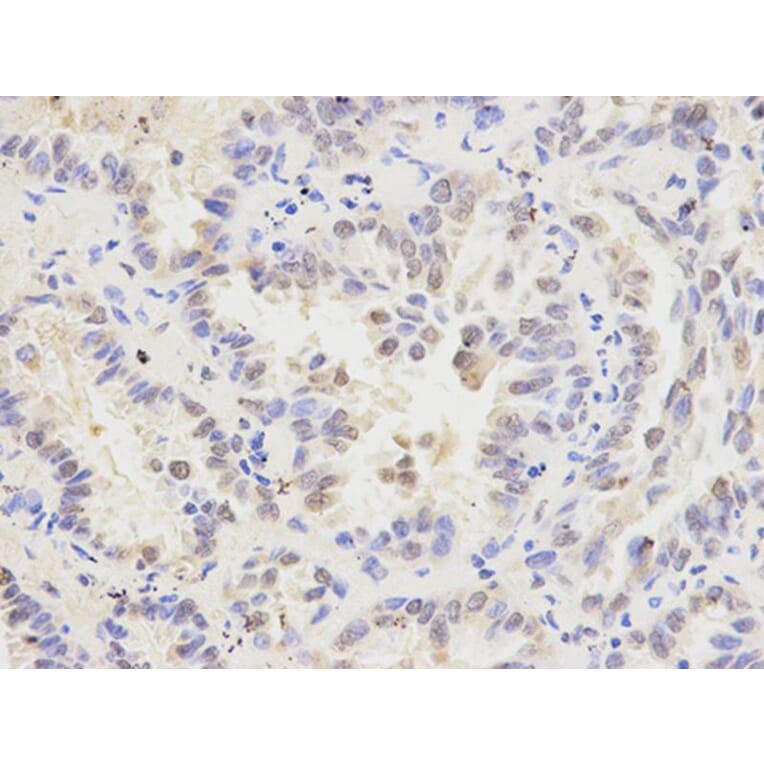 Immunohistochemistry - MAD1L1 Antibody from Signalway Antibody (32187) - Antibodies.com