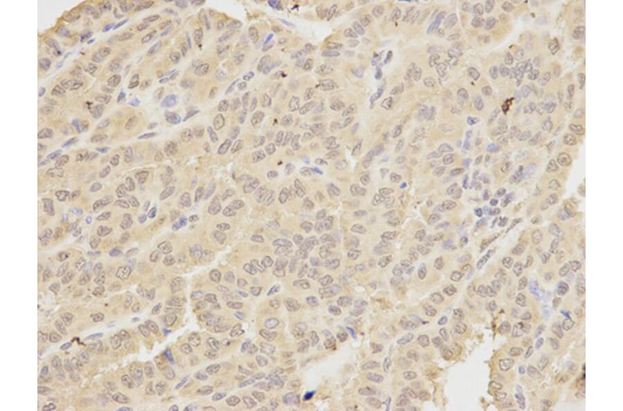 Immunohistochemistry - MAD1L1 Antibody from Signalway Antibody (32187) - Antibodies.com