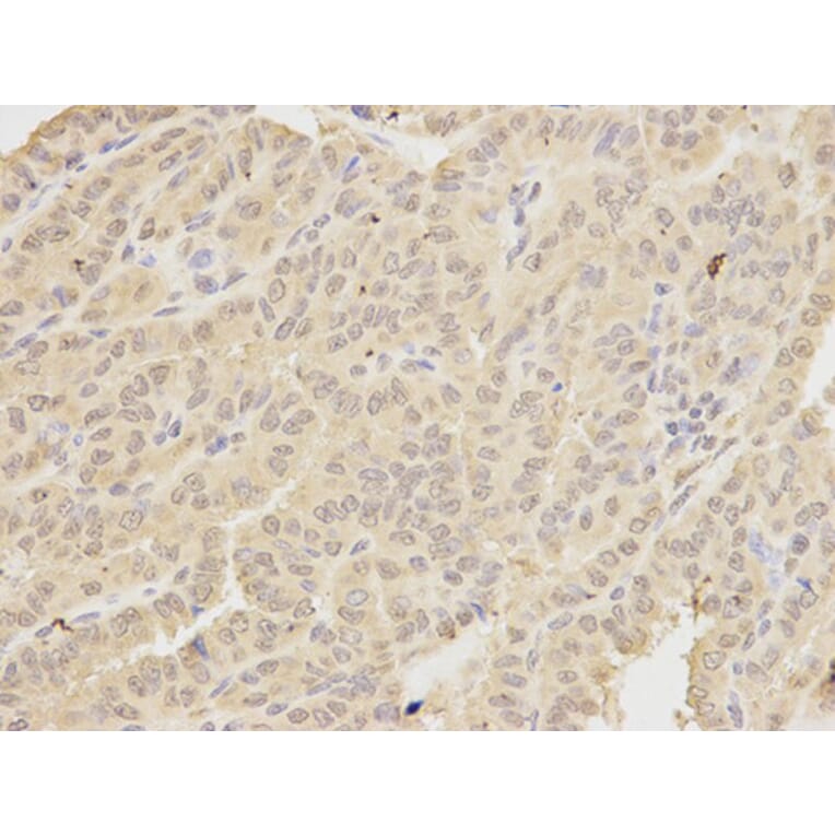 Immunohistochemistry - MAD1L1 Antibody from Signalway Antibody (32187) - Antibodies.com