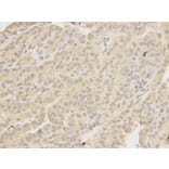 Immunohistochemistry - MAD1L1 Antibody from Signalway Antibody (32187) - Antibodies.com