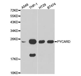 Western blot - PYCARD Antibody from Signalway Antibody (32200) - Antibodies.com